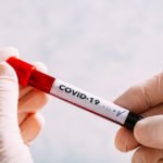 Premiers tests virologiques du diagnostic du CoVID-19 réalisés par le laboratoire de virologie du CHU TTA