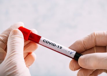 Premiers tests virologiques du diagnostic du CoVID-19 réalisés par le laboratoire de virologie du CHU Mohammed VI - Tanger